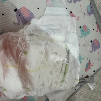 Defolu Bebek Bezleri: Sleepy'nin Kontrol Eksikliği