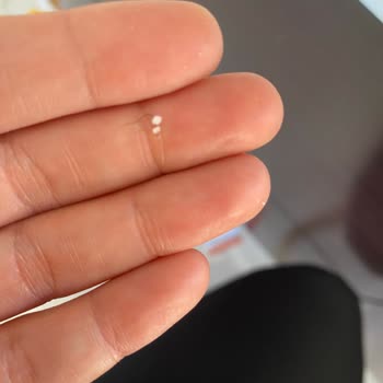 Tuzda Siyah Parçalar Ve Kıl Şoku