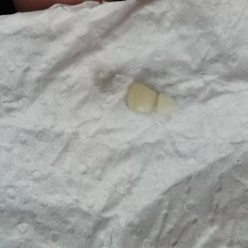 BİM'den Aldığım Helvada Şok Edici Yabancı Madde