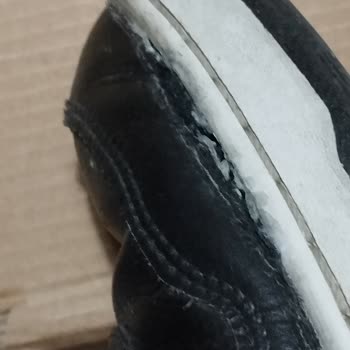 Ayakkabıda Açılma Sorunu Ve Mağduriyet