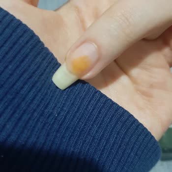 Flormar Oje Tırnaklarda Kalıcı Lekeler Bırakıyor