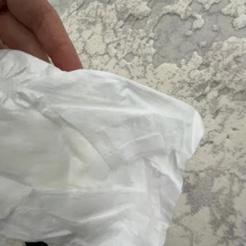 Hatalı Bebek Bezi Ve Ebebek Müşteri Hizmetleri Sorunu