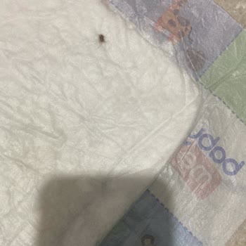 Hijyen Sorunu: Bebek Alt Açma Bezinde Böcek