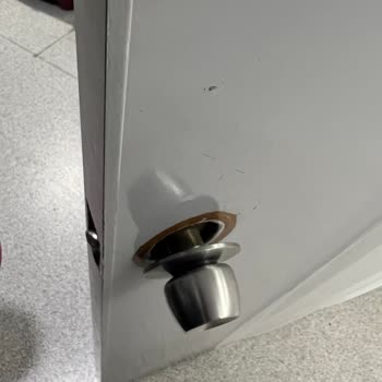 Özel Hastanede Yüksek Ücretler Karşısında Bakımsız Odalar Ve Rahatsız Yataklar