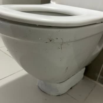 Özel Hastanede Yüksek Ücretler Karşısında Bakımsız Odalar Ve Rahatsız Yataklar