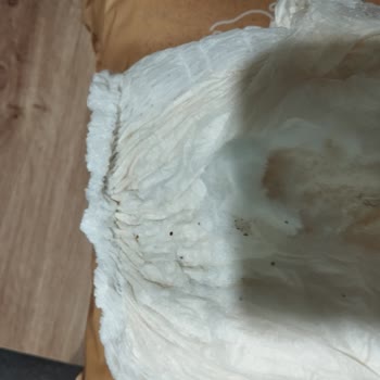 Sleepy Bebek Bezlerinde Cilt Sorunları Ve Kalite Problemi