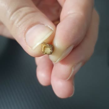 Ay Işığı Tatlıcısı Ankara Fıstıklı Baklavadan Çıkan Yabancı Madde Şoku!