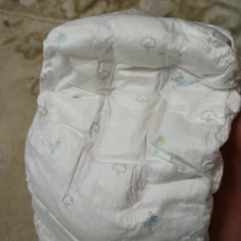 Sleepy Bebek Bezlerinde Üretim Hatası Mağduriyeti