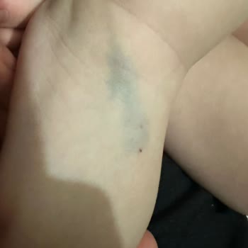 Hastanede Yetersiz Hizmet Ve Hijyen Sorunları