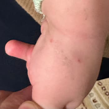 Hastanede Yetersiz Hizmet Ve Hijyen Sorunları