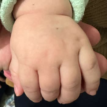 Hastanede Yetersiz Hizmet Ve Hijyen Sorunları