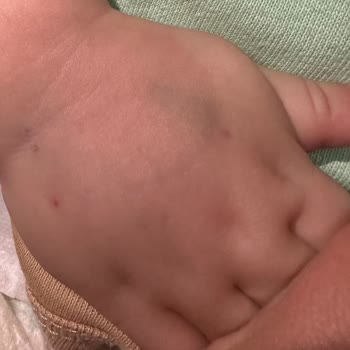 Hastanede Yetersiz Hizmet Ve Hijyen Sorunları