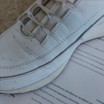 Tergan Ayakkabıda Hayal Kırıklığı: 1 Haftada Soyulan Deri