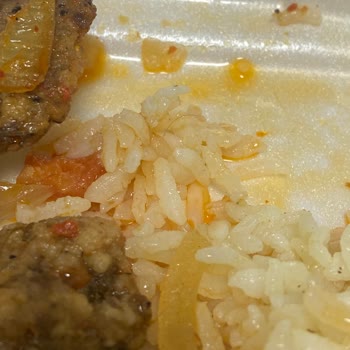 Yemek Siparişlerinde Hijyen Problemleri