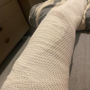 English Home Sıcak Su Torbası Patladı: Ciddi Yanık Ve Sağlık Sorunları