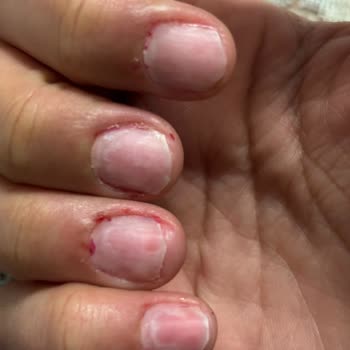 Aymira Koçaklı Yaşam Merkezi Çerkezköy Şikayeti