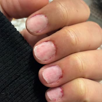 Aymira Koçaklı Yaşam Merkezi Çerkezköy Şikayeti