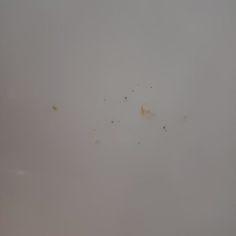 Arçelik Güvencesindeki Buzdolabı Paslanma Sorunu