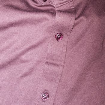 Gömleklerde Tiftiklenme Sorunu Ve Mağaza İlgisizliği