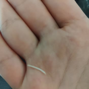 Ton Balığı Konservesinde Sağlık Tehlikesi