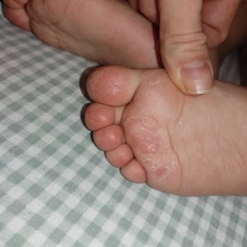 Ayakkabının Sağlık Sorunlarına Yol Açması Ve Değişim Talebi