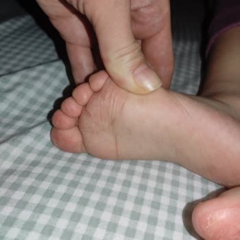 Ayakkabının Sağlık Sorunlarına Yol Açması Ve Değişim Talebi