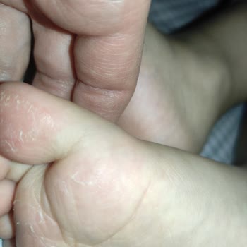 Ayakkabının Sağlık Sorunlarına Yol Açması Ve Değişim Talebi