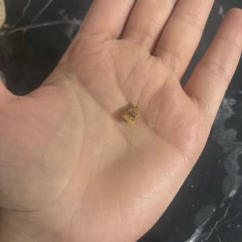 Granola Yüzünden Diş Kırılması