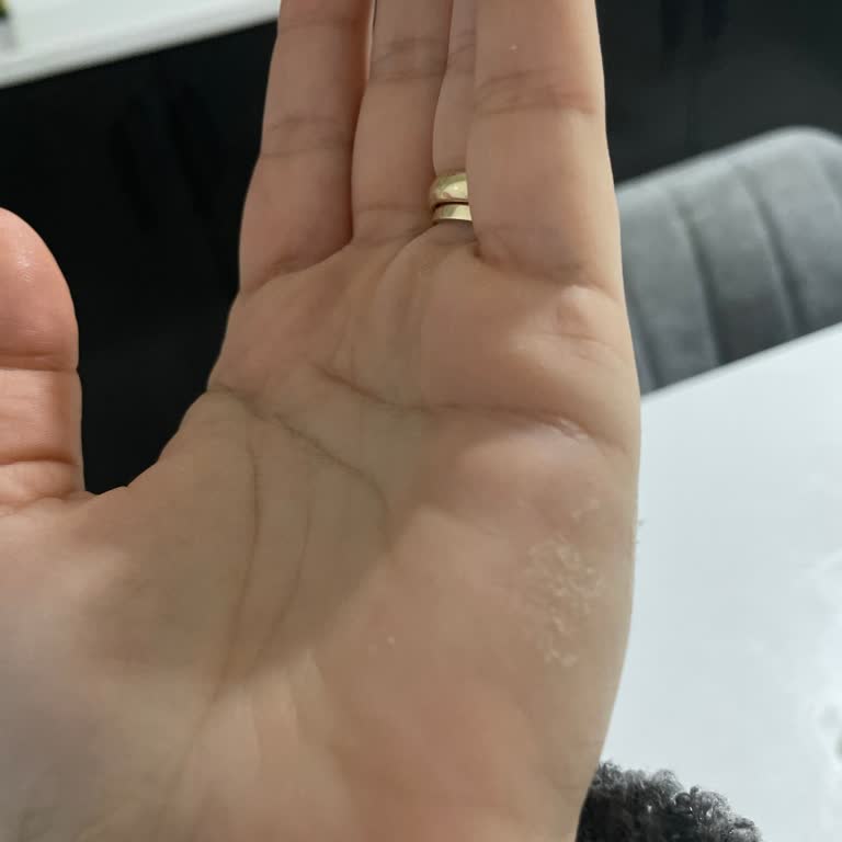 Duru Sabun Ciltte Tahriş Ve Kaşıntı Yapıyor