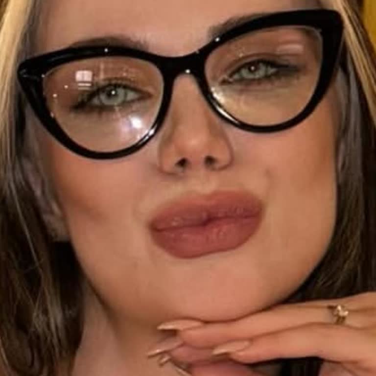 Opmar Optik'te Kırılan Gucci Çerçeve Ve Çözüm Eksikliği