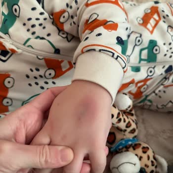 Medicana Hospitals Çocuğuma Uygun Tedavi Sağlanmadı