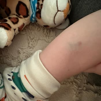 Medicana Hospitals Çocuğuma Uygun Tedavi Sağlanmadı