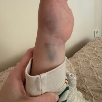 Medicana Hospitals Çocuğuma Uygun Tedavi Sağlanmadı