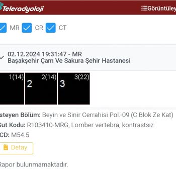 MR Sonuçları Neden Bu Kadar Gecikti