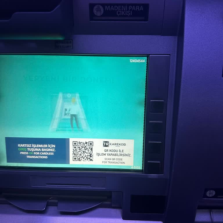 ATM Para Yatırma Sorunu Ve Müşteri Hizmetleri Desteği Eksikliği