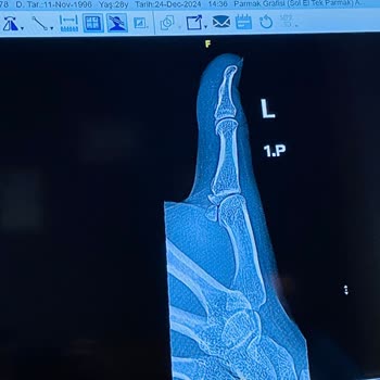 Hastane Hatası: Yanlış Teşhis Ve Tedavi Mağduriyeti