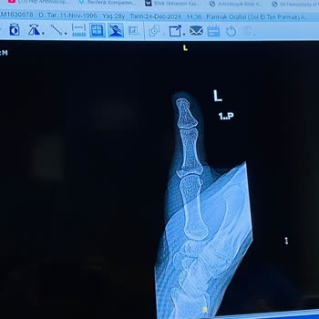 Hastane Hatası: Yanlış Teşhis Ve Tedavi Mağduriyeti