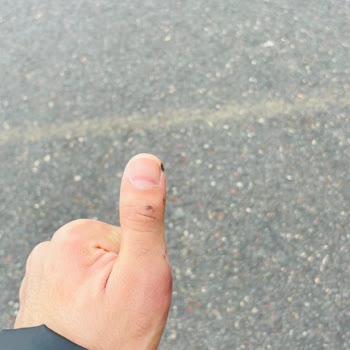 Hastane Hatası: Yanlış Teşhis Ve Tedavi Mağduriyeti