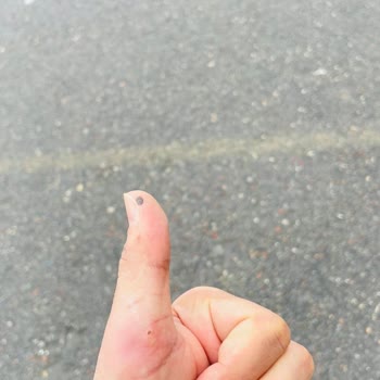 Hastane Hatası: Yanlış Teşhis Ve Tedavi Mağduriyeti