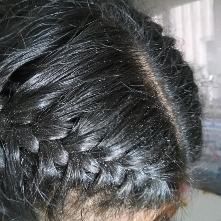 Saç Köpüğü Beklentileri Karşılamıyor