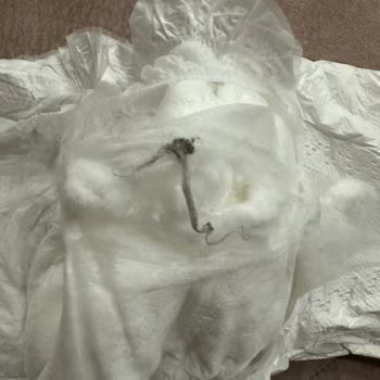 Baby Turco Bebek Bezi Hijyen Sorunu