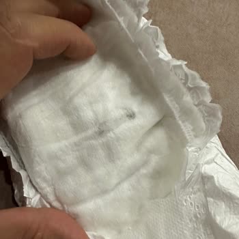 Baby Turco Bebek Bezi Hijyen Sorunu