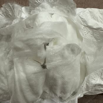 Baby Turco Bebek Bezi Hijyen Sorunu