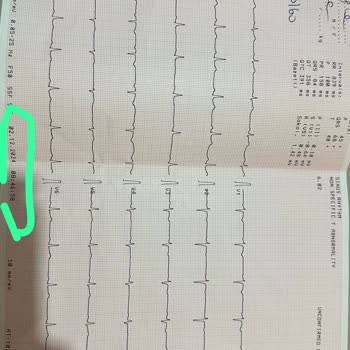 Yanlış Tanı Tarihi İle Ek Ücret Mağduriyeti