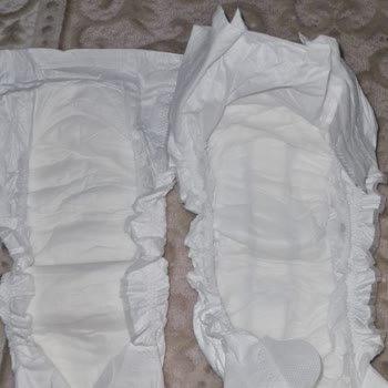 Sleepy Natural Bebek Bezi Şikayeti