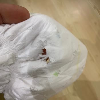 Hatalı Sleepy Bebek Bezleri: Çocuk Sağlığı Tehlikede!