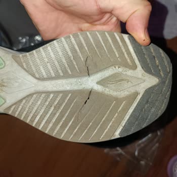 Skechers Ayakkabının Tabanı Neden Çabuk Yıprandı?