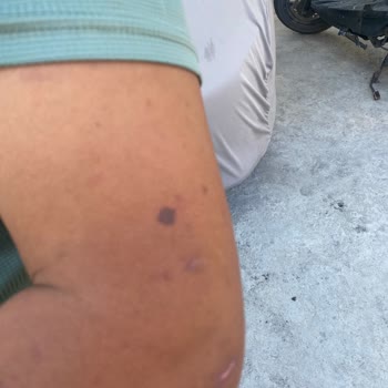 Epilasyon Hizmetinde Sorumluluk Alınmıyor