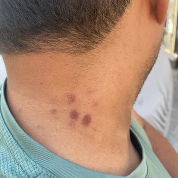 Epilasyon Hizmetinde Sorumluluk Alınmıyor