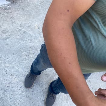 Epilasyon Hizmetinde Sorumluluk Alınmıyor